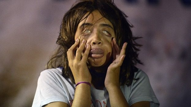 دختر زشت