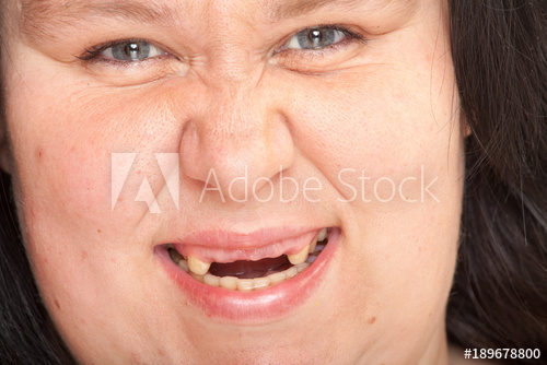 دختر زشت خنده دار