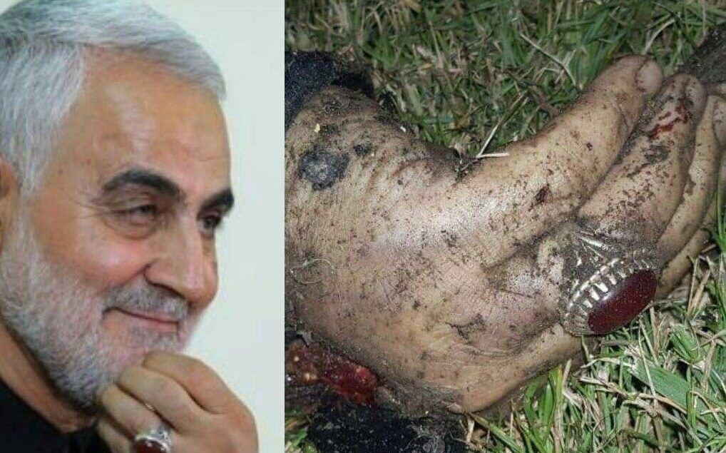 عکس دست حاج قاسم سلیمانی بعد از شهادت